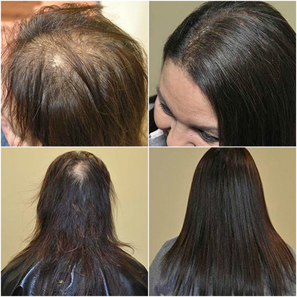 Extensions for Thinning Hair – Di Biase Hair Extensions USA Store